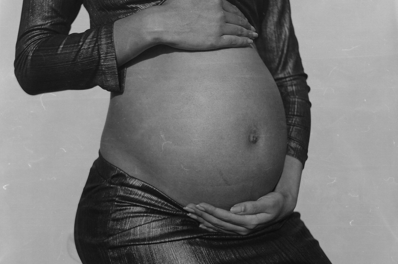 Stretch Marks During Pregnancy